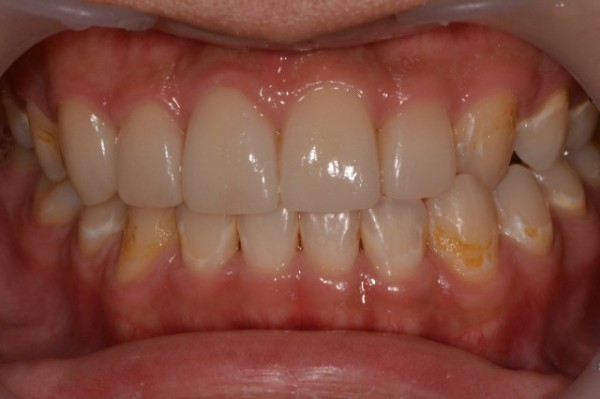 73bde1dca4952344964fff091cafa12a_1758088389_9479.jpg
